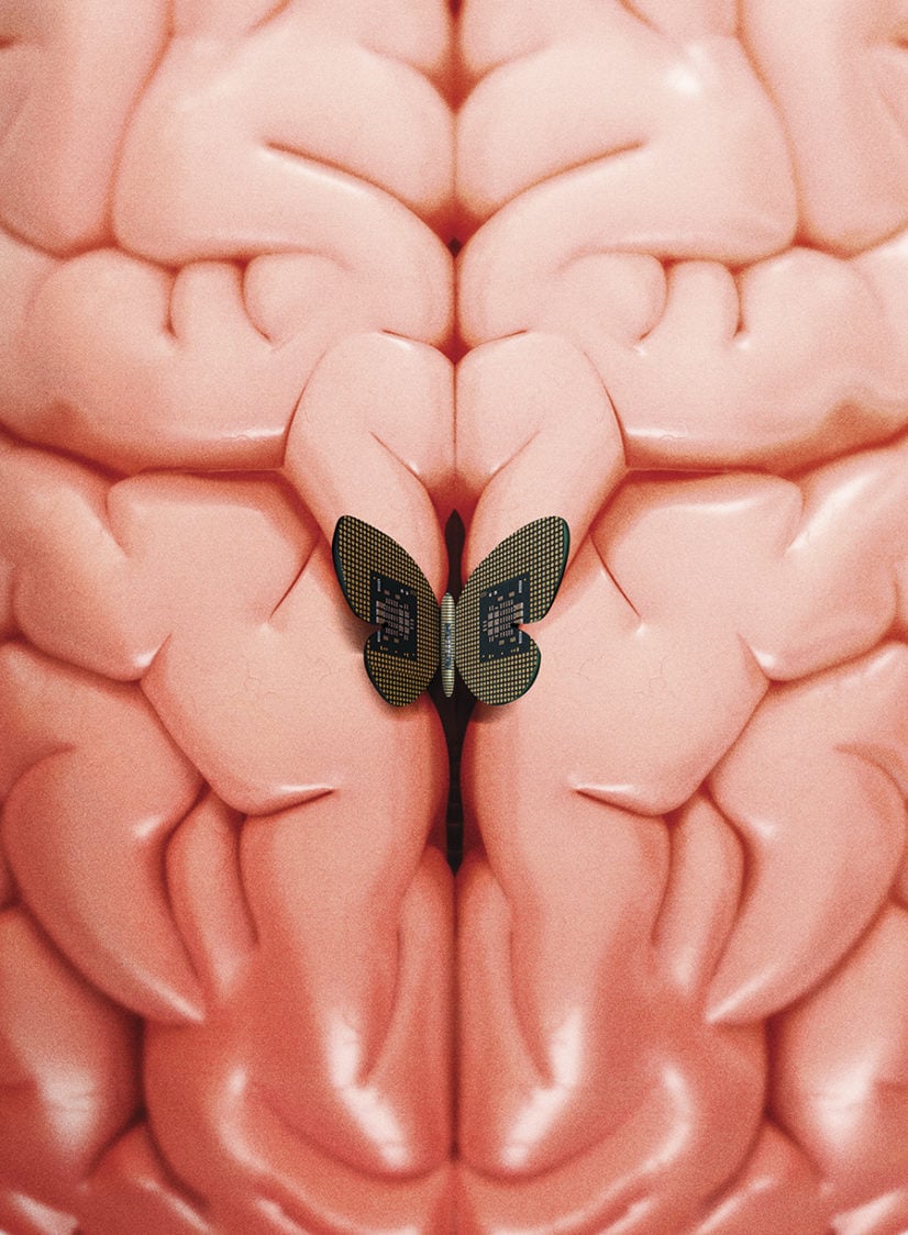 A Hole in the Head, by Zachary Siegel