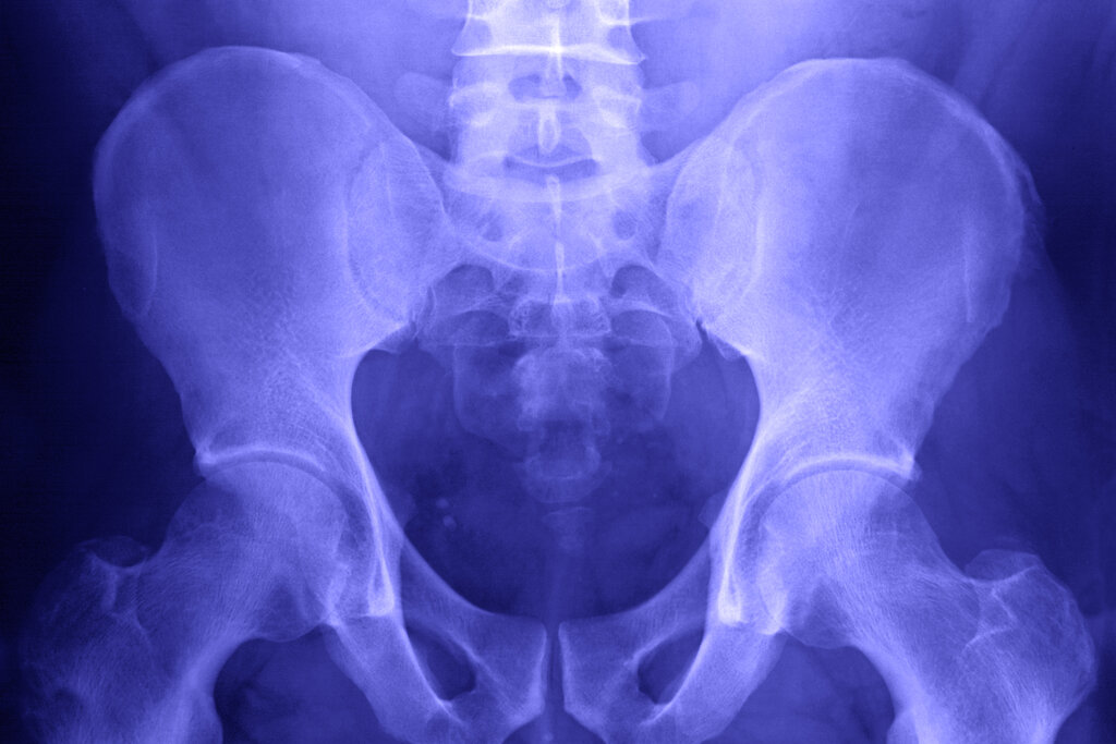 How Humans Lost Their Tails