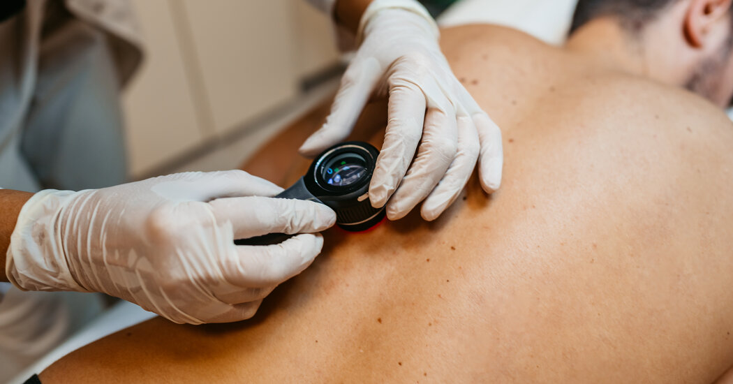 How to Avoid One of the Deadliest Forms of Skin Cancer