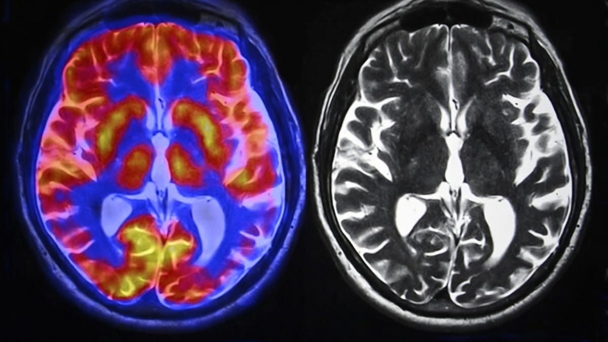 How AI Affects Your Brain According to the Studies: A (Very Big) Compilation