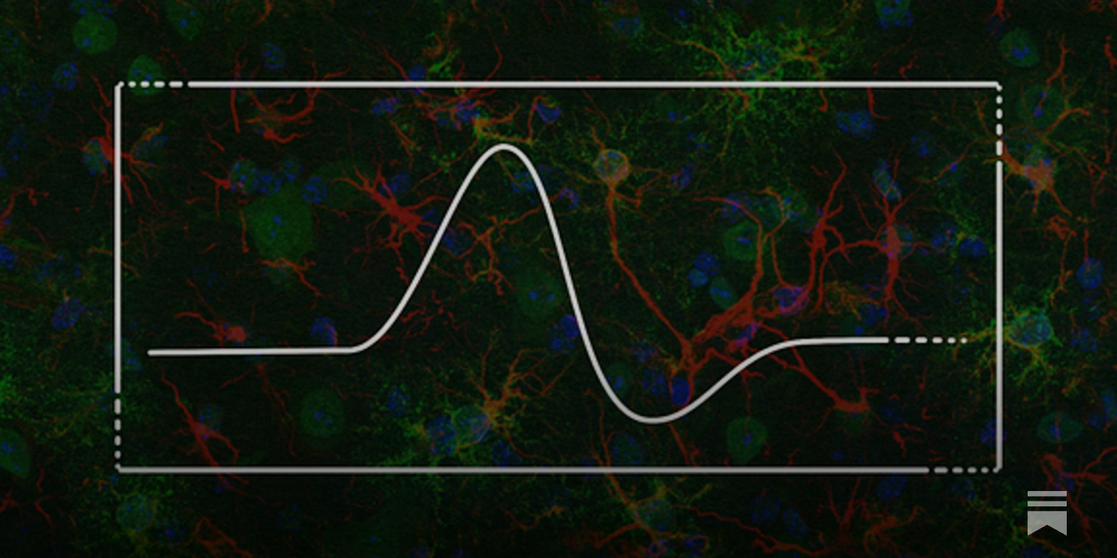 What Makes an Experiment Beautiful?