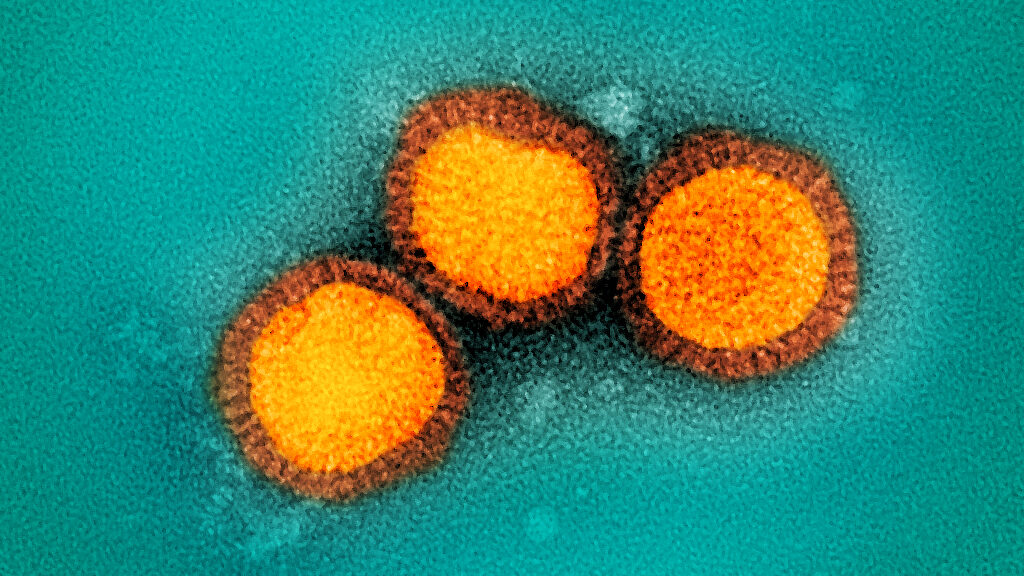 The FDA has cleared the first home flu and Covid test — but its maker just declared bankruptcy